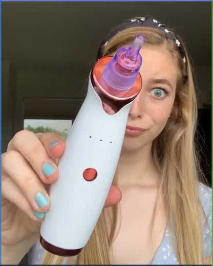 ✨ Extracteur de Sébum DermaSuction – 4 embouts magiques pour une peau parfaite 💎